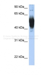ARP41696_P050 - LCAT