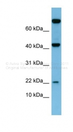 ARP41697_P050 - Leptin