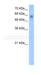 ARP41701_T100 - Protein C / PROC
