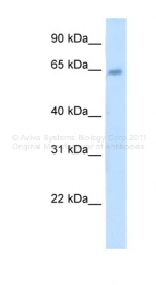 ARP41710_T100 - Steryl-sulfatase