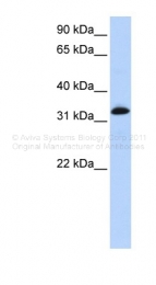ARP41717_P050 - Cardiac Troponin T