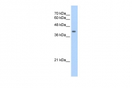 ARP41724_T100 - UROD