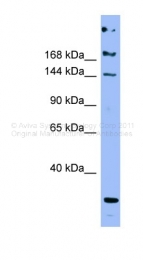 ARP41726_P050 - Apolipoprotein B / Apo B