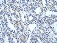 ARP41733_P050 - Cytokeratin 17