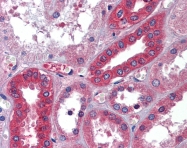 ARP41746_P050 - Albumin