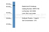 ARP41756_P050 - Prothrombin (F2)
