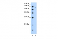 ARP41758_T100 - Fibrinogen alpha chain