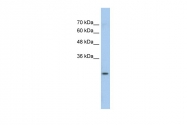 ARP41769_P050 - GSTM1