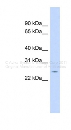ARP41771_P050 - C-reactive protein (CRP)