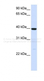 ARP41785_P050 - Alcohol dehydrogenase 1A / ADH1
