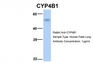 ARP41814_P050 - CYP4B1