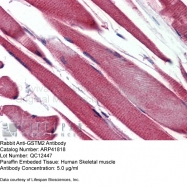 ARP41818_P050 - GSTM2 / GST4