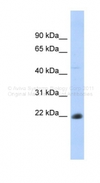 ARP41928_P050 - CD40