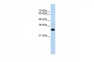 ARP41929_P050 - CD40