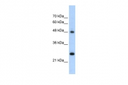 ARP41930_T100 - Chromogranin A