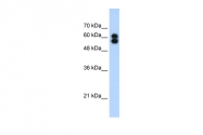 ARP41959_T100 - Alkaline phosphatase / PLAP / ALPP