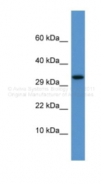 ARP41961_P050 - Apolipoprotein F / Apo F
