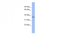 ARP41984_P050 - Proteoglycan link protein / HAPLN1