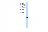 ARP41986_T100 - Cystatin-S
