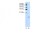 ARP42010_T100 - Glucagon