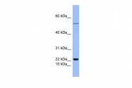ARP42011_P050 - Glucagon