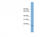 ARP42018_P050 - Glutathione peroxidase 2 / GPX2