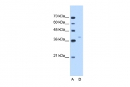 ARP42031_T100 - Cytokeratin 13