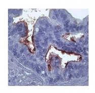 ARP42039_T100 - MMP-1