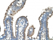 ARP42039_T100 - MMP-1