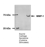 ARP42039_T100 - MMP-1