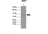 ARP42039_T100 - MMP-1