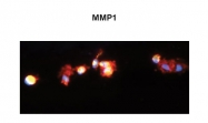 ARP42040_T100 - MMP-1