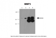 ARP42042_P050 - MMP-3