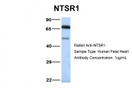 ARP42048_P050 - Neurotensin receptor 1