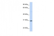 ARP42104_P050 - Stanniocalcin 1 / STC1