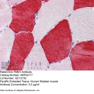 ARP42117_P050 - Skeletal muscle Troponin I