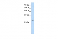 ARP42117_P050 - Skeletal muscle Troponin I
