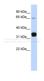 ARP42120_P050 - Skeletal muscle Troponin T