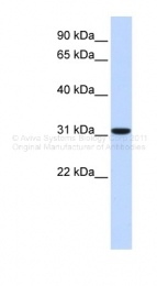ARP42167_P050 - Carbonic anhydrase 8