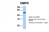 ARP42183_P050 - DMPK