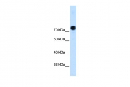 ARP42202_T100 - Alpha-actinin-4 / ACTN4