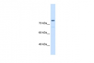 ARP42203_P050 - Alpha-actinin-4 / ACTN4