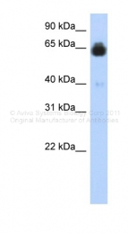 ARP42207_P050 - IGFALS / ALS