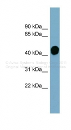 ARP42219_P050 - Haptoglobin