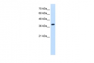ARP42237_T100 - Isocitric dehydrogenase alpha / IDH3A