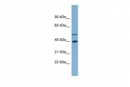 ARP42238_P050 - Isocitric dehydrogenase alpha / IDH3A