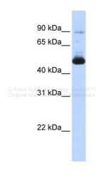 ARP42241_P050 - Cytokeratin 16
