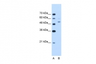 ARP42254_T100 - Visfatin / NAMPT
