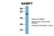 ARP42255_T100 - Visfatin / NAMPT
