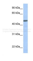 ARP42260_P050 - CGRP type 1 receptor / CRLR